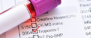troponin t test