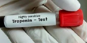 troponin i test