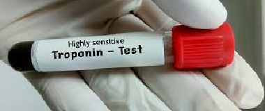 troponin i test