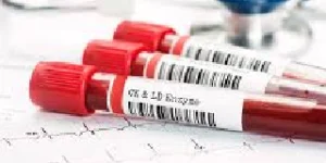 creatine kinase ck test