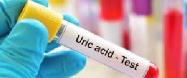 uric acid test