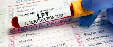 liver function test lft