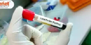 lipid profile test