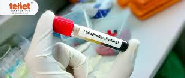 lipid profile test