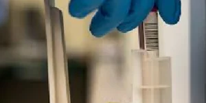 glucose 6 phosphate dehydrogenase g6pd test