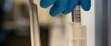 glucose 6 phosphate dehydrogenase g6pd test