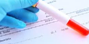 full blood count fbc test