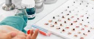 sickling and hemoglobin electrophoresis test
