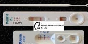 malaria parasite test