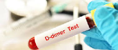 d dimer test