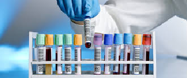Blood Group (ABO & Rh Factor) Test