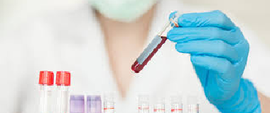 2-Hour Postprandial Blood Glucose Test