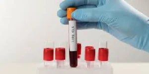high vaginal swab hvs test