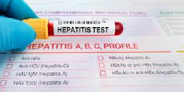 hepatitis b virus hbv profile test v