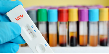 hepatitis c virus hcv antibody test