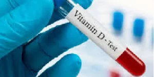 vitamin d test
