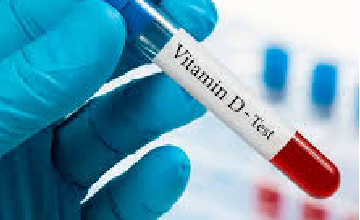 vitamin d test