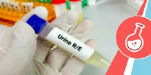 urine routine examination test