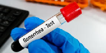 gonorrhea test
