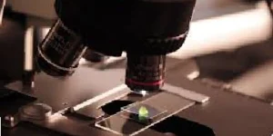 fecal occult blood fob test