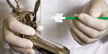 cervical swab test