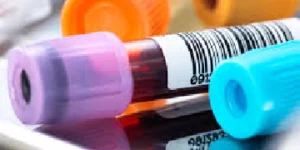 Sickling and Hemoglobin Electrophoresis Test (Copy)