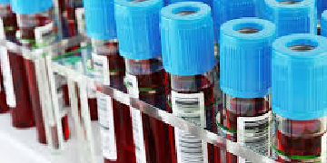 Amylase Test