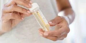 urethral swab test