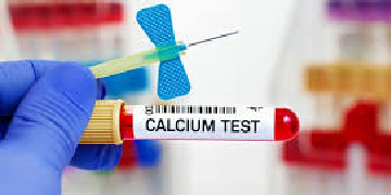 Calcium Test
