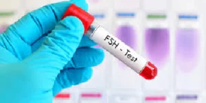 follicle stimulating hormone fsh test