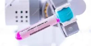 luteinizing hormone lh test