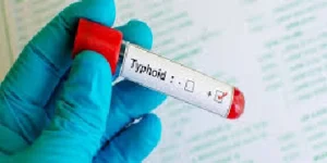 typhoid igm igg antibody test
