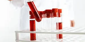 phosphorus test