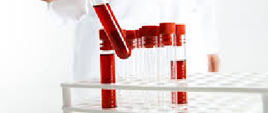 phosphorus test
