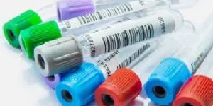 progesterone test