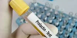 prolactin test