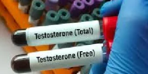 testosterone test
