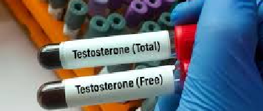 testosterone test
