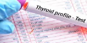 thyroid function test tft