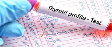 thyroid function test tft