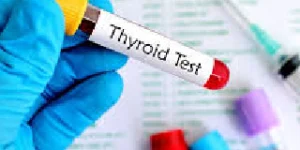 thyroid stimulating hormone tsh test