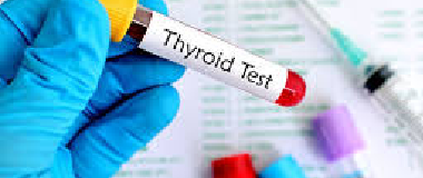 thyroid stimulating hormone tsh test