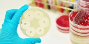 urine culture susceptibility test