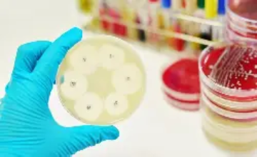 urine culture susceptibility test