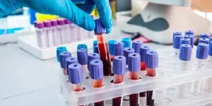 throat swab test