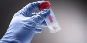 stool routine examination test