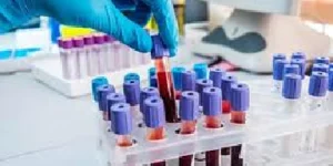 stool culture susceptibility test