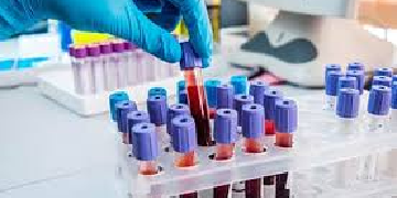 stool culture susceptibility test