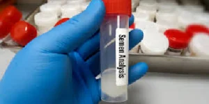 semen routine analysis test